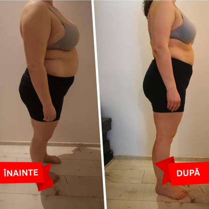 Transformare Corporală 3 Luni – 90 Plasturi | Pachet Promo Intensiv