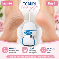 Aparat Electric pentru Îndepărtarea Pielii Îngroșate și a Calusului de pe Călcâie – PediVac